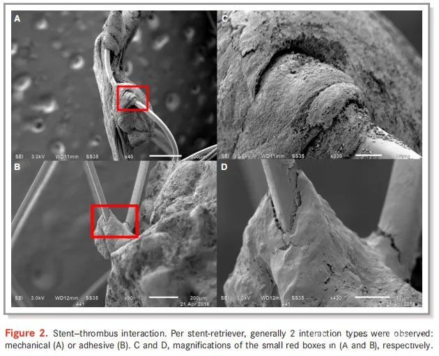 vascular implants
