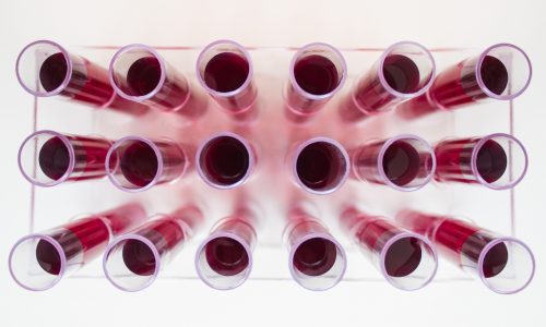 Medical tubes with blood Laboratory glass chemical test tubes with red liquid or blood.
